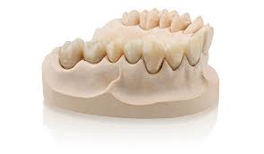 teeth mold for dentists and orthodontists