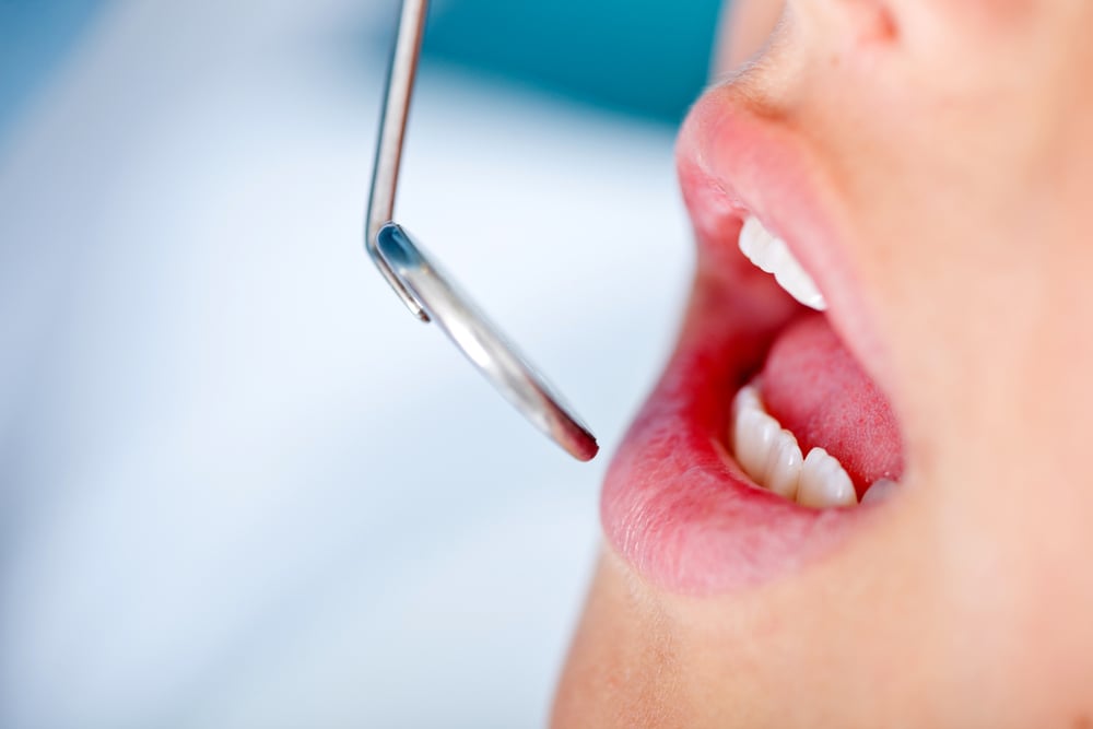 Close up of patients mouth in a visit to the dentist-1