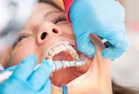 Clove Dental dentistry Camarillo