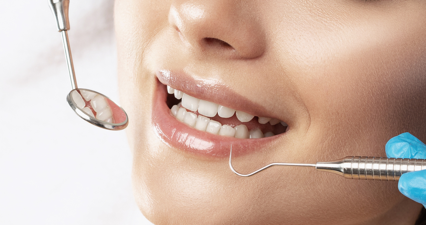 Dental-sealants-for-families-in-Los-Angeles