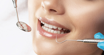 Invisalign dentist in Ventura
