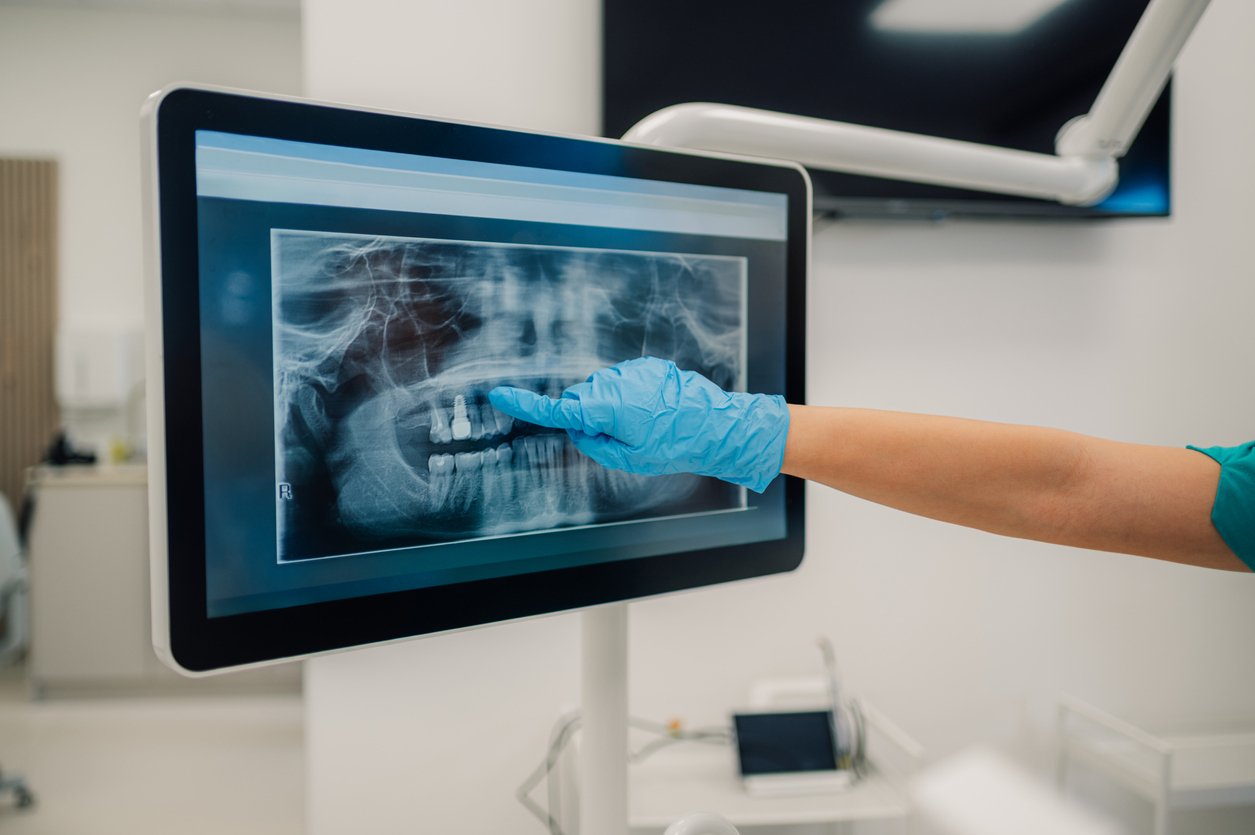 Diagnostic-schedule-for-x-rays