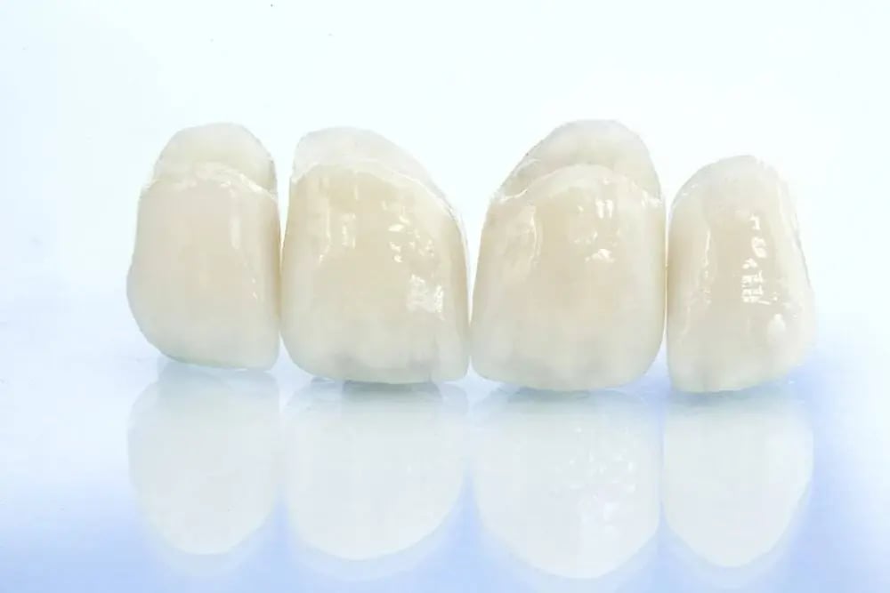 Porcelain-crowns Porcelain-crowns