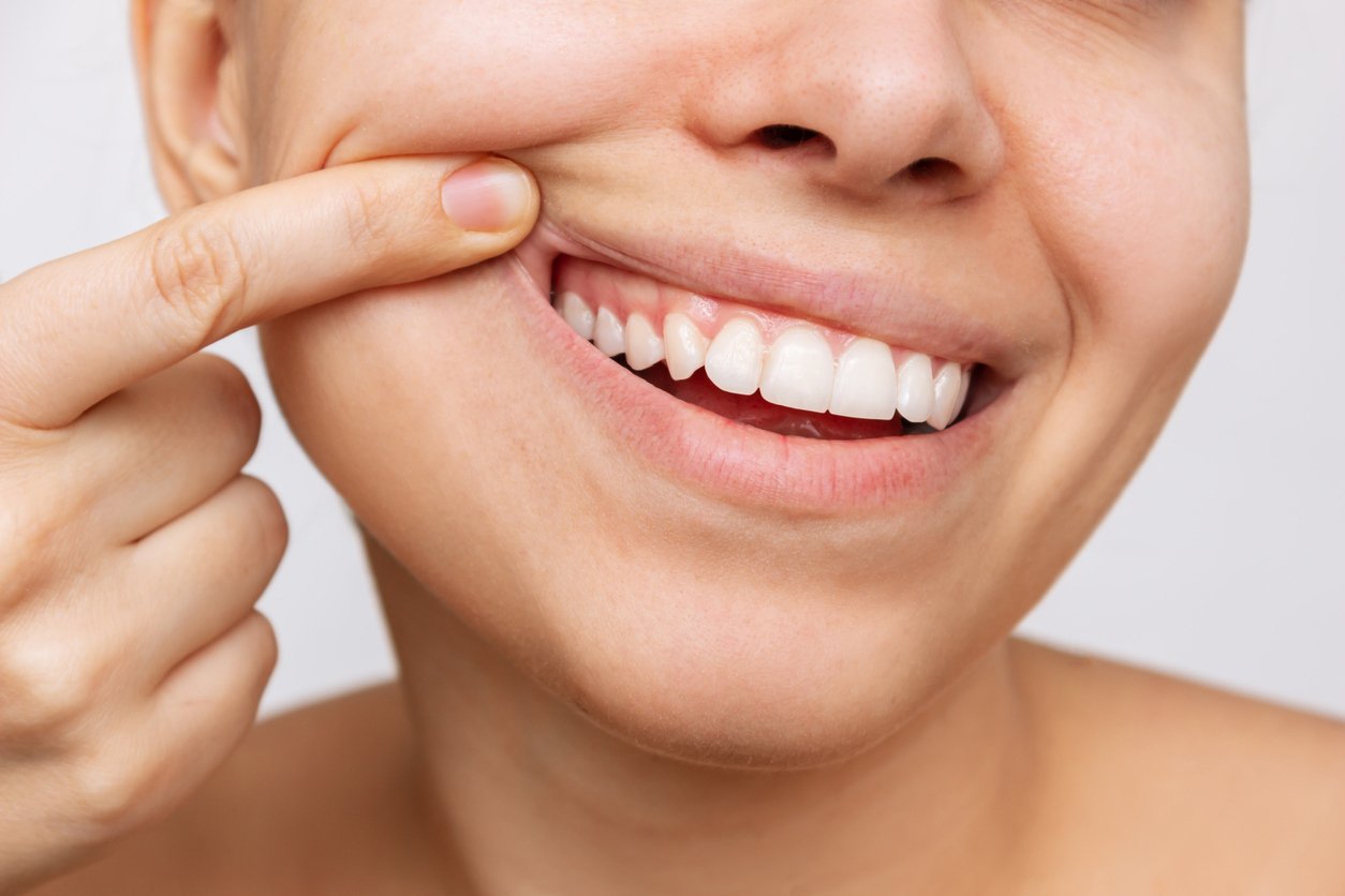 The-outcome-of-ignoring-bleeding-gums