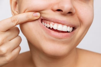 Invisalign dentist in Ventura