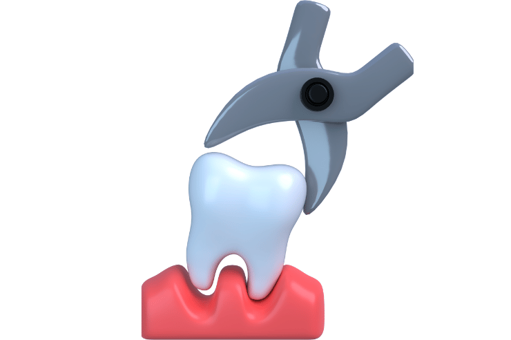 Teeth Extractions in Ventura County