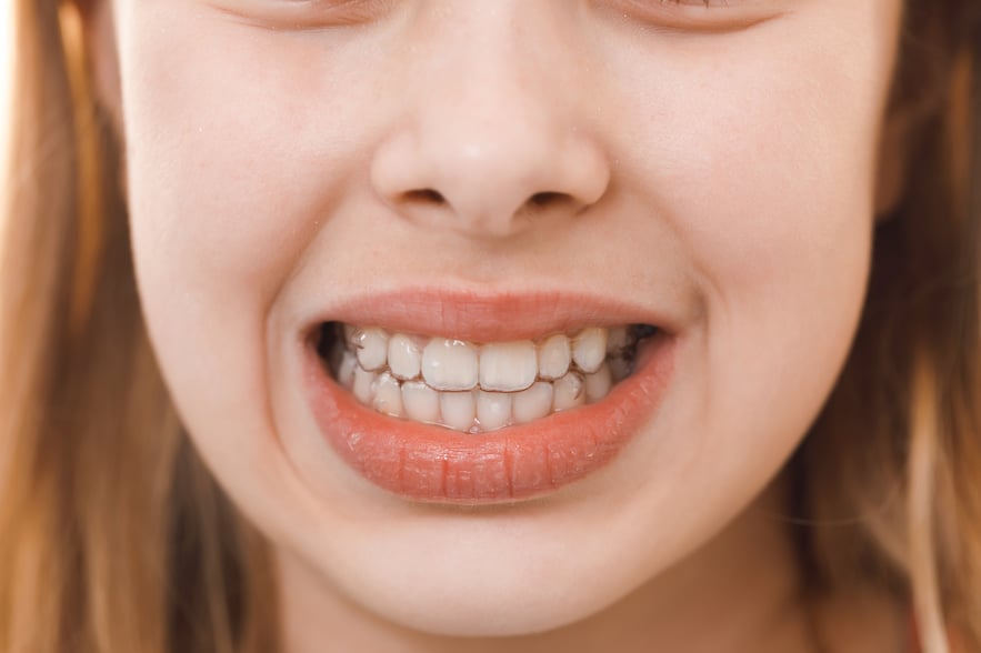 beautiful-smile-young-girl