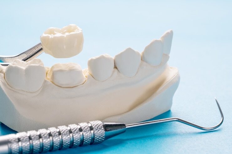 Dental crowns