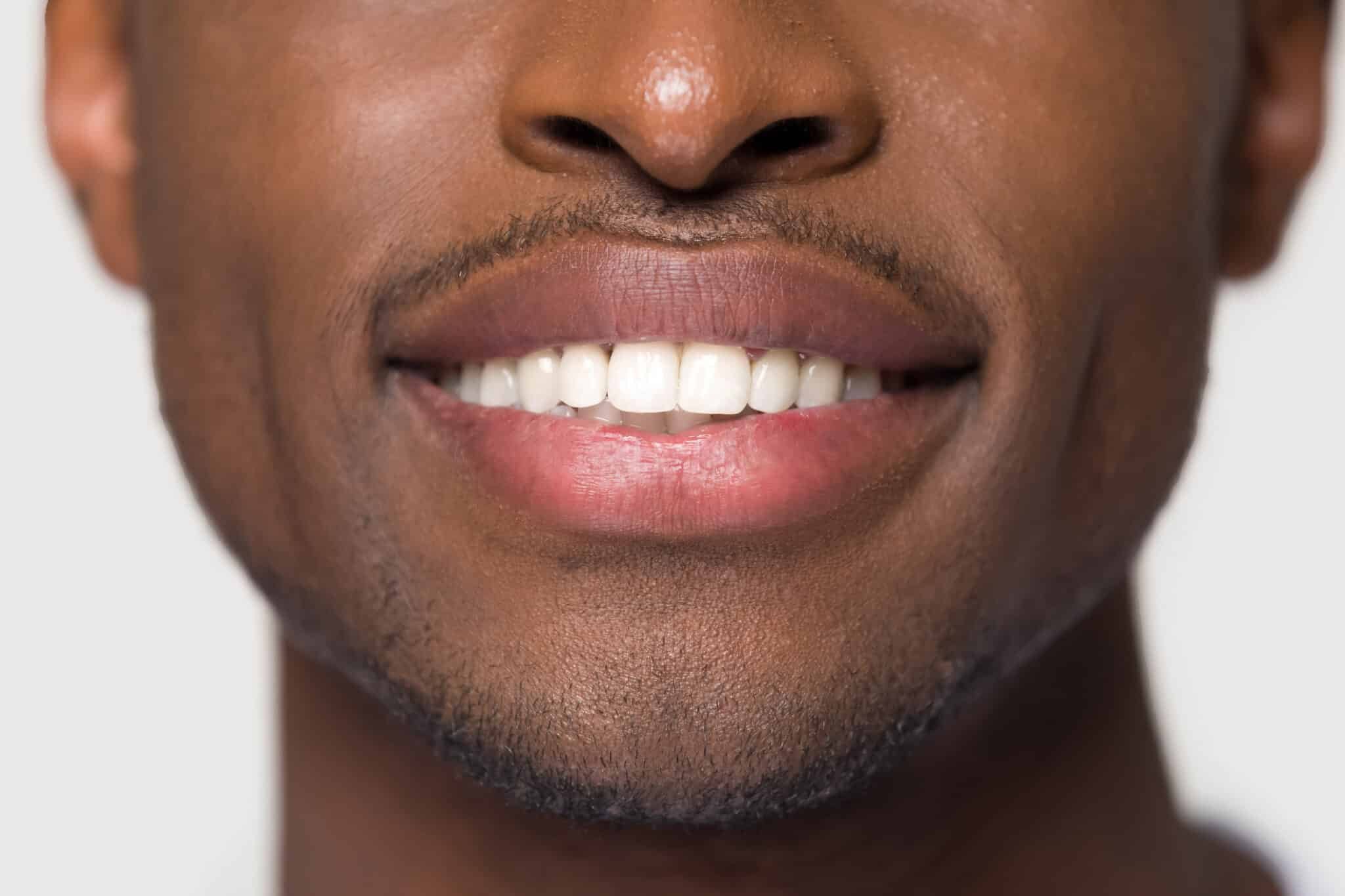comparing-dry-socket-and-normal-extraction-healing