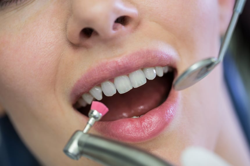 dentist-examining-female-patient-with-tools