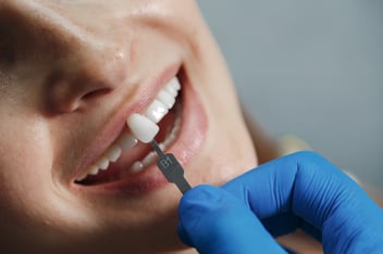 dental veneers thousand oaks        
