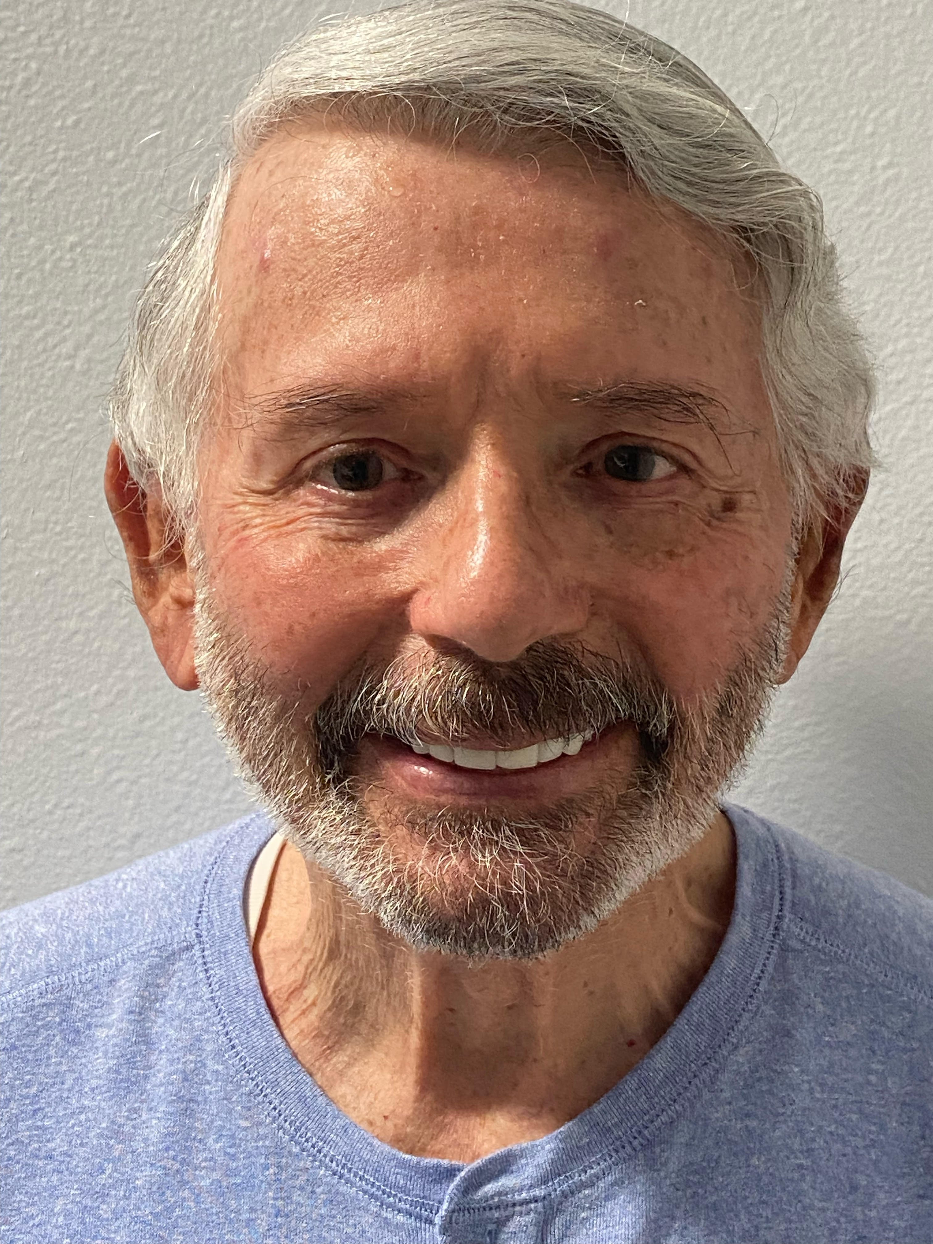 Dentist in Thousand Oaks Cosmetic, Teeth Whitening Implants & Dentures