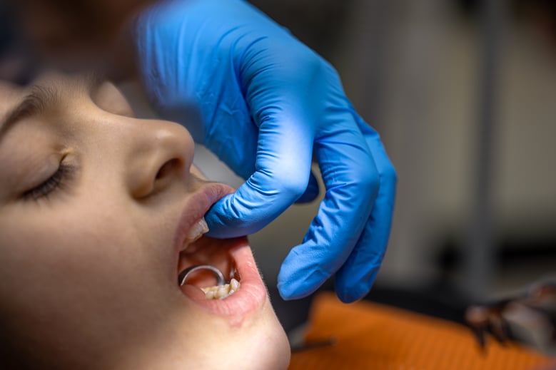 girl-dentists-office-dentist-examining-child-patients-teeth-dentistry-concept (1)