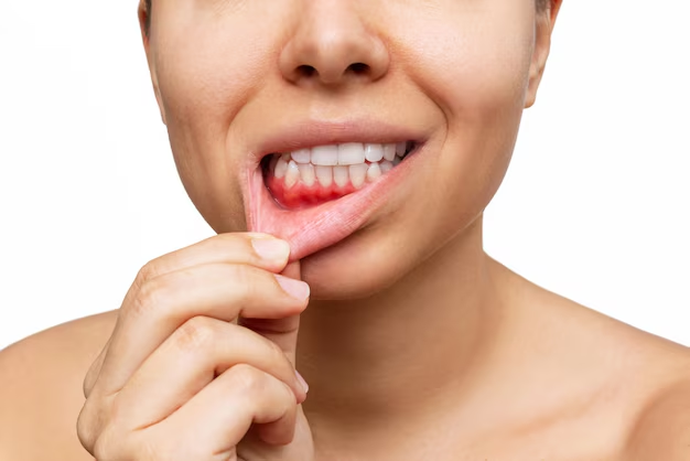 Gum Disease / Periodontics in Sherman Oaks