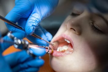 pediatric dentist in Santa Monica