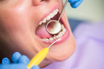 dentist in Camarillo