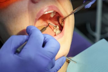 dentist in Beverly Hills