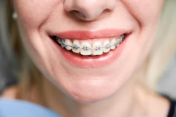 orthodontist in Sherman Oaks