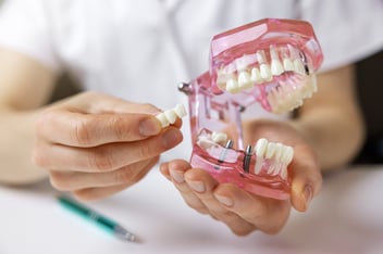Invisalign dentist in Ventura