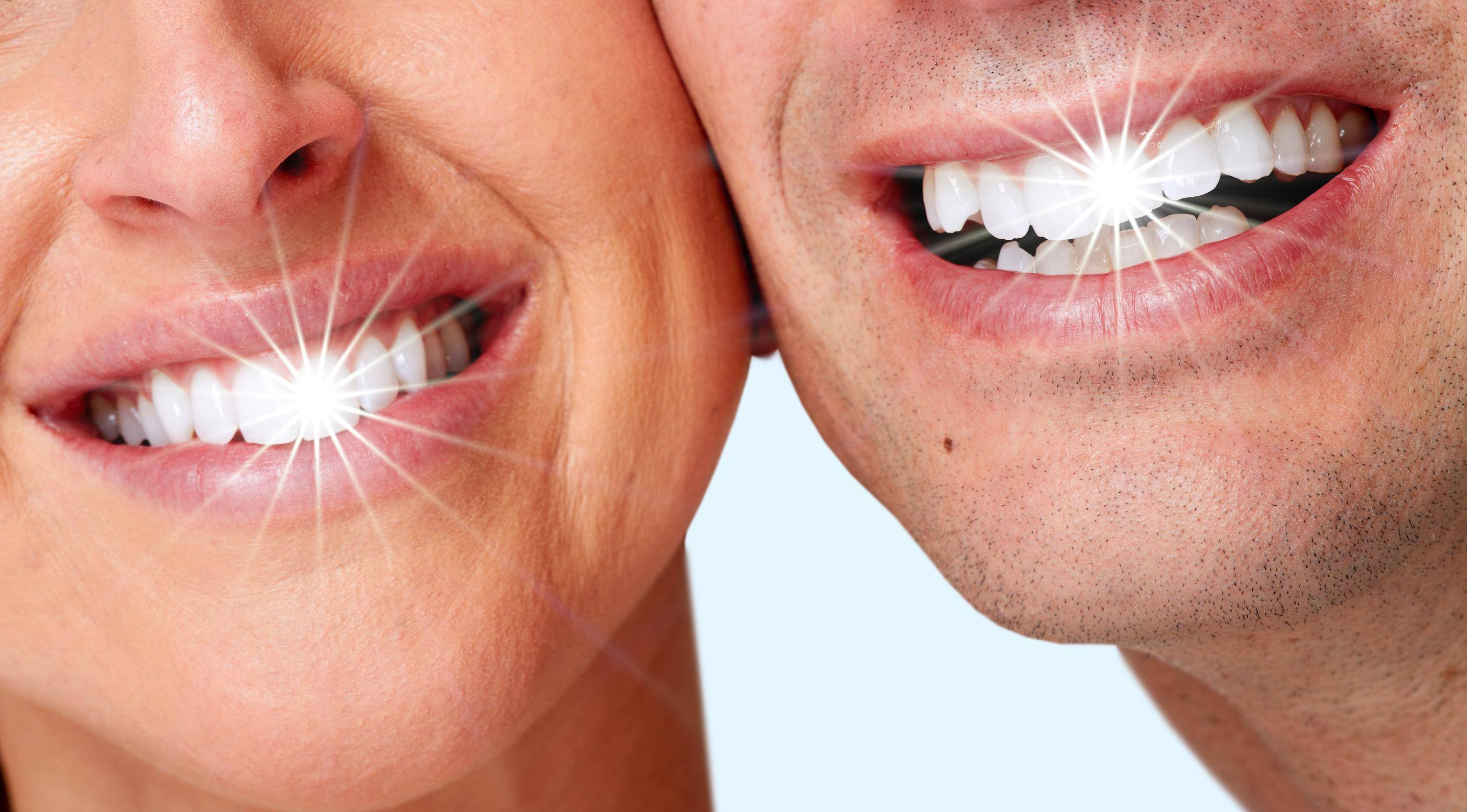 teeth-whitening1_14