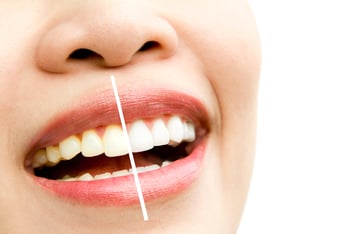 dental checkup with Clove Dental