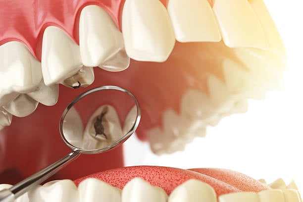 oral hygiene clove dental camarillo