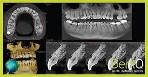 dental x-ray