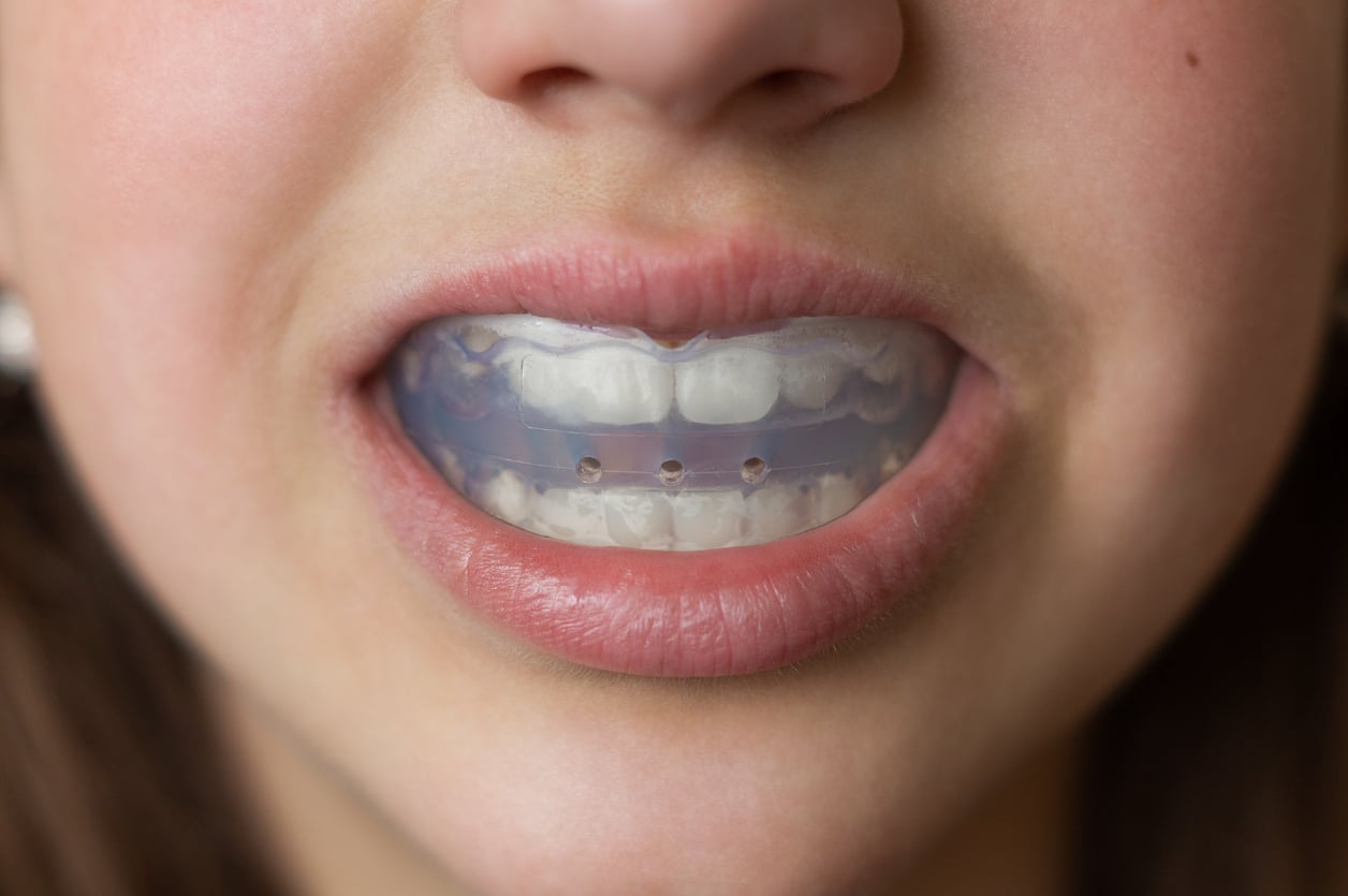 Invisalign dentist in Ventura