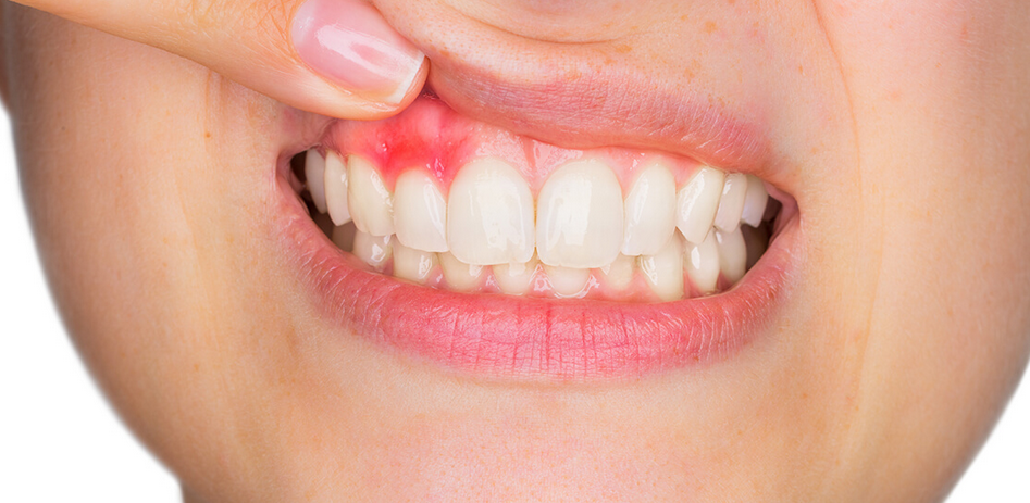 Thousand Oaks dental care