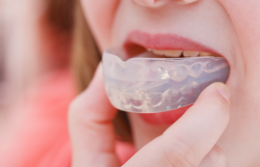 flag football mouthguard