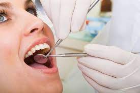 teeth cleaning at Camarillo dentists Clove Dental