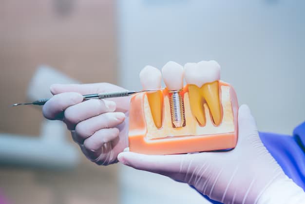 Dental implants in Ventura