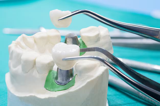 dental crowns in Camarillo
