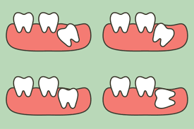 restorative dentistry in Camarillo