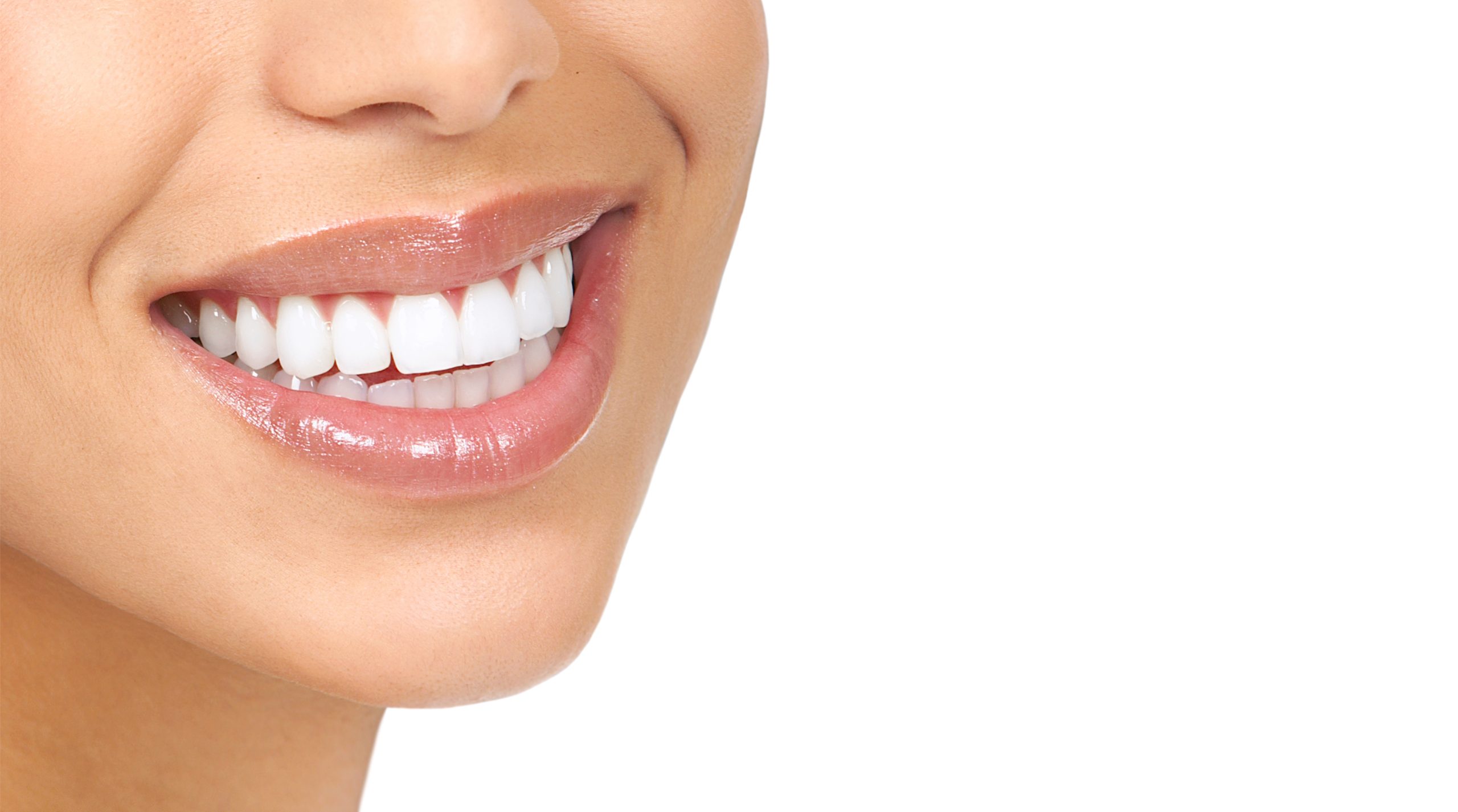 porcelain veneers encino