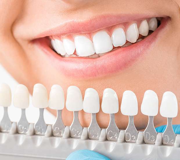 best cosmetic dentistry in Camarillo