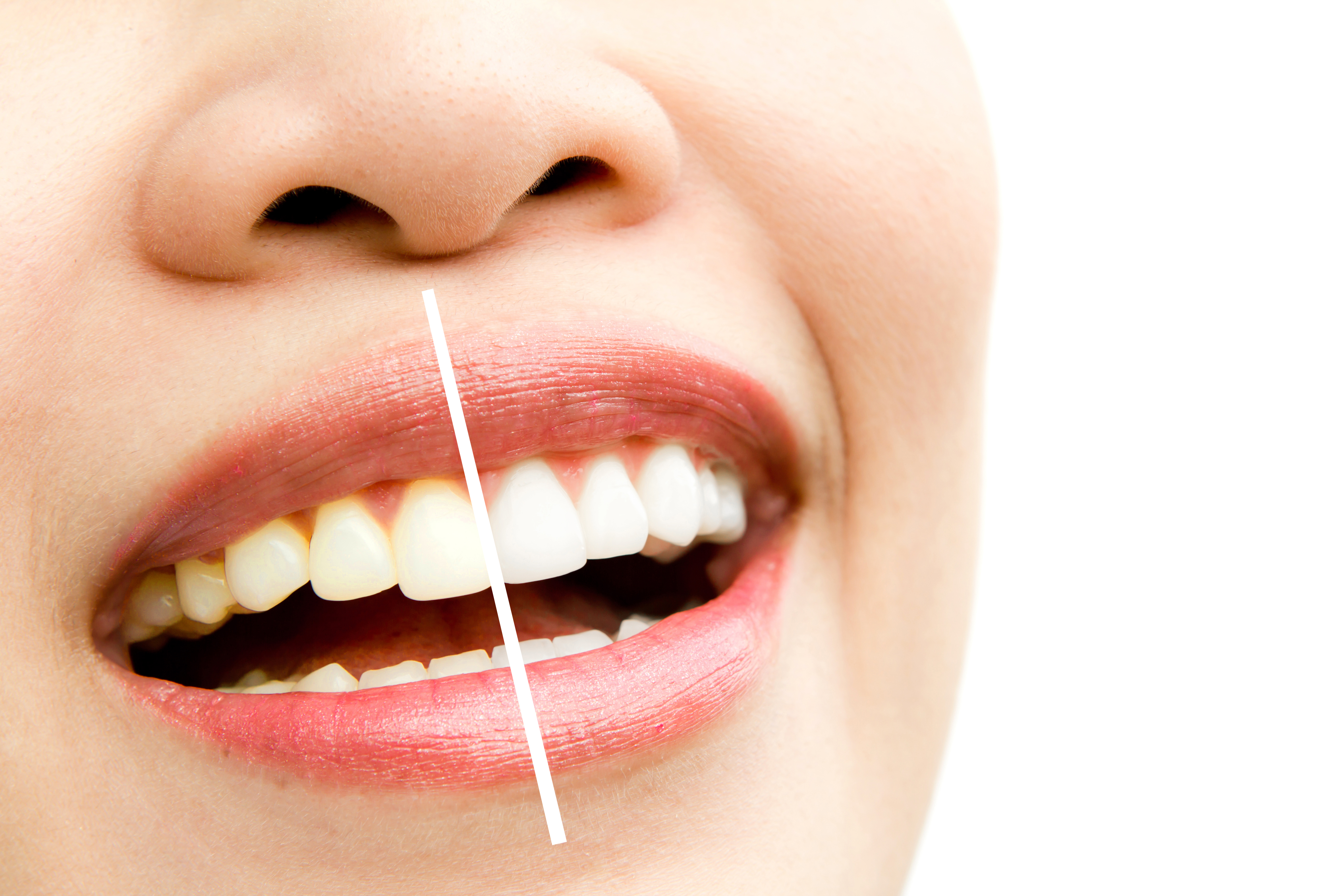 dental checkup with Clove Dental